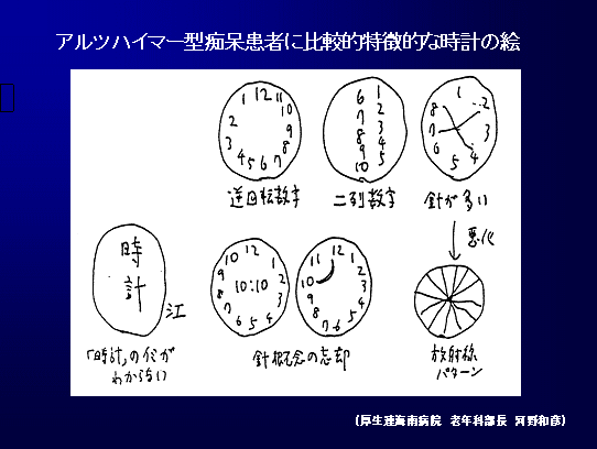 認知症の人に時計の絵 トップ